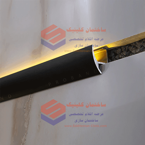 پرولایت آپ آلومینیومی (Prolight Up) - تصویر 4